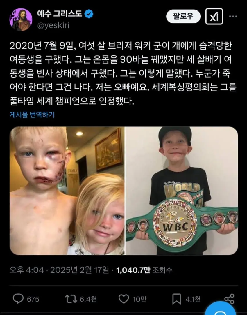 동생을 개로부터 구한 오빠 근황