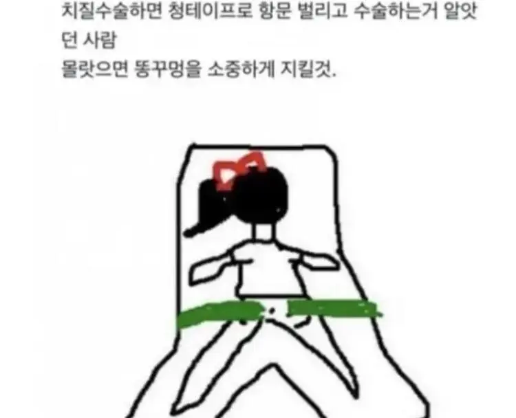 똥구멍을 소중히 여기지 않았던 사람의 최후